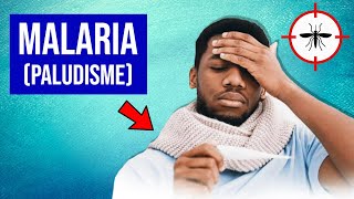 Malaria Paludisme  Symptômes et Traitements [upl. by Dohsar]