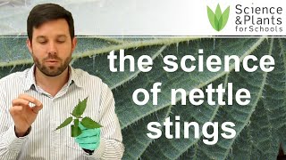 How do stinging nettles sting you  practical biology experiment 🌵🧪 [upl. by Nnazus]