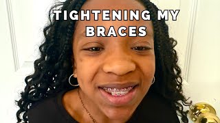 Before amp After Braces Tightening  Tween Explains [upl. by Pepito]