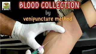 Blood collection by venipuncture method l How to collect venous blood l safe and effective way [upl. by Bachman]