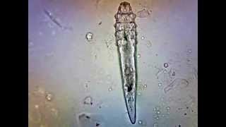 Demodex Canis Nużeniec Psi w badaniu mikroskopowym [upl. by Airotnahs799]