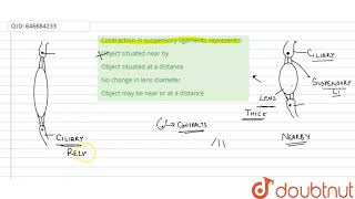 Contraction in suspensory ligaments represents  12  SENSORY ORGANS RECEPTORS  EYE amp EAR [upl. by Howenstein723]
