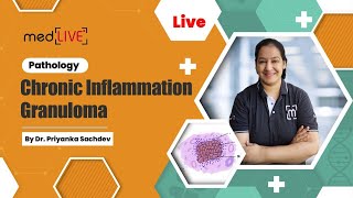 Chronic Inflammation  Granuloma with Dr Priyanka Sachdev [upl. by Atnicaj]