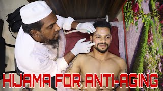 HIJAMA FOR ANTIAGING amp GLOWING SKIN  HINDI  ANI RAY [upl. by Ocirema]