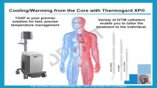 Hypothermia for acute treatment of ischemic stroke by Patrick Lyden MD [upl. by Ennaharas]