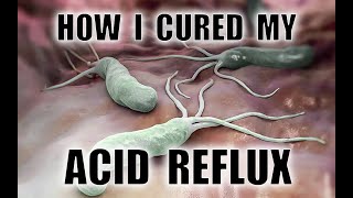 How I cured my Acid Reflux and Helicobacter Pylori infection without antibiotics [upl. by Wanonah]