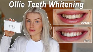 Ollie Teeth Whitening Strips better then HiSmile  a very honest review [upl. by Onidranreb]