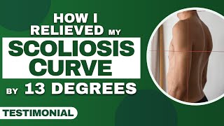 Scoliosis Curve Reduction of 13 Degrees for Adult Male  Patient Testimonial [upl. by Sudbury]