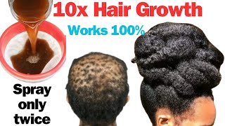 3 Important Ingredients You Need To Grow Back Your Bald Spots and Stop Hair Thinning [upl. by Madelin]