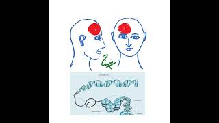 Radiotherapy in Locally advanced cervical cancer [upl. by Ifill]