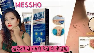 Wart Remover Review 2023 Instant Blemish Removal Gel [upl. by Ardnaid]