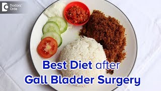 Diet after Laparoscopic Cholecystectomy Gall bladder surgery  Dr Nanda Rajaneesh [upl. by Vance60]