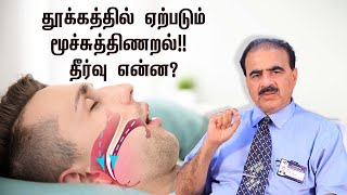 What is Obstructive Sleep Apnea  தூக்கத்தால் ஏற்படும் இருதய சம்பந்தப்பட்ட நோய்  Samayam Tamil [upl. by Karina]