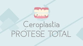 Ceroplasia da prótese total PT [upl. by Nnaarual202]