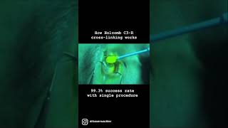 Keratoconus Treatment with NonInvasive Holcomb C3R shorts keratoconus [upl. by Keil]