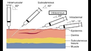 Intravenous IV Cannulation Procedures [upl. by Glynias44]