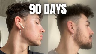 How To GROW A BEARD In 90 Days Using MINOXIDIL amp DERMA ROLLER [upl. by Noimad]