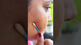 7Days Dark Spots amp Pigmentation Removal ChallengeGet Rid Of Dark SpotsGet Glowing Skin shorts [upl. by Analahs]