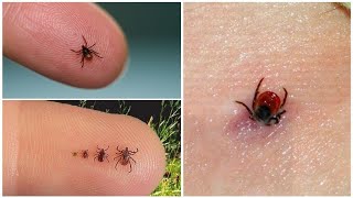 ✅What happens if the tick to inject hydrogen peroxide [upl. by Pournaras]