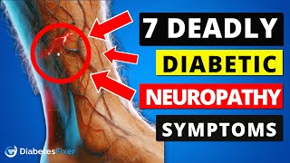 Top 7 Diabetic Neuropathy Symptoms You Shouldnt Ignore [upl. by Cattima]