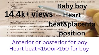 My baby reports placenta position and heart beat of gender based on placenta positionbaby reports [upl. by Theobald]