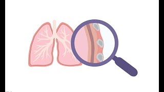 How to interpret lung ultrasound in COVID 19 and other diseases SARSCoV2 Coronavirus [upl. by Scarlett608]