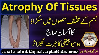 Atrophy Of Tissues جسم مین سکڑاؤ शारीरिक संकुचन Homeopathic Treatment In Urdu  Hindi [upl. by Enuj]