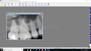 Training Apteryx XrayVision 4 Moving Images Between Patient Charts [upl. by Emili678]