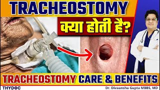 Tracheostomy क्या होती है  जानिए Tracheostomy के Benefits और Tracheostomy Care कैसे करें in Hindi [upl. by Nollaf]