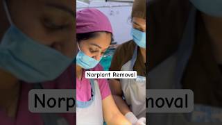 Norplant Removal — Full video click above👆🏻 contraceptives birthcontrol norplant shorts [upl. by Fawne]