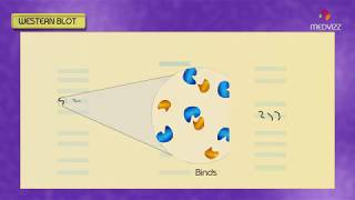 Western blot  Southern blot  Northern blot  South western Blot  Animation [upl. by Krigsman501]