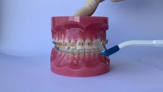 INTERDENTAL BRUSHING SHEFFIELD ORTHODONTICS [upl. by Lecroy]