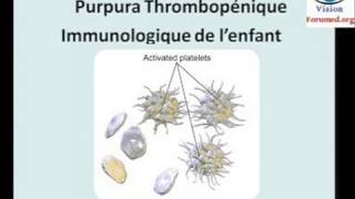 Purpura Thrombopénique immunologique physiopathologie diagnostic [upl. by Cleave]