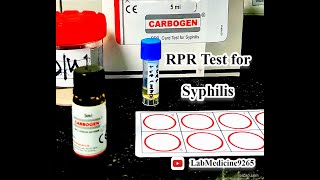 Rapid Plasma Reagin RPR Test  Serology  tulipdiagnosticspvtltdgoa [upl. by Ilajna660]