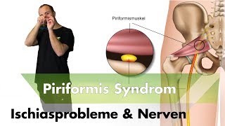 Ischialgie amp Piriformissysndrom  Nervensystem  Das solltest du über Schmerzen wissen [upl. by Wilmott961]
