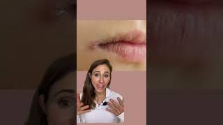 How To Get Rid Of Angular Cheilitis For Good dermatologist [upl. by Nakashima]