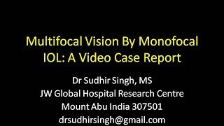 Multifocal Vision 66 N6 By Monofocal IOL  A Video Case Report [upl. by Boyce]