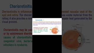 Chorioretinitis  Inflammation of Choroid and Retina [upl. by Pedrotti]