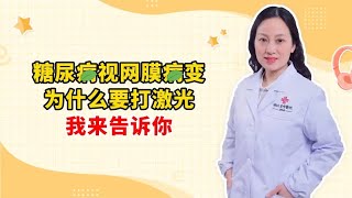 糖尿病视网膜病变 为什么要打激光 我来告诉你 [upl. by Cony937]