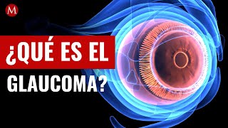 ¿Qué es el glaucoma cuáles son los síntomas y cómo se trata [upl. by Htebyram]