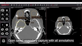 MedDream DICOM Viewer saving viewport content as DICOM secondary capture [upl. by Upton664]