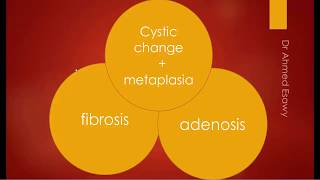 Breast fibrocystic change fibroadenosis sonomammography MRI [upl. by Fabrice860]