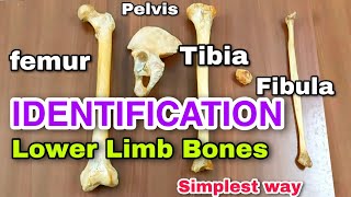 lower limb bones ll identification ll side determination  anatomy of lower limb  bones [upl. by Ynahpets]