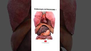 Endoscopic Ultrasound procedure  Short Animated Video [upl. by Washburn]