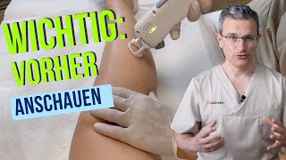 Haarentfernung mit Laser oder IPL Ablauf Erfolge Risiken und Tipps von Dr Robert Kasten Mainz [upl. by Carlisle]