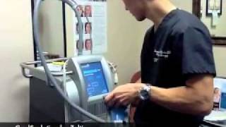 CoolSculpting NonSurgical Fat Reduction Las Vegas NV  Samuel Sohn MD [upl. by Hong]