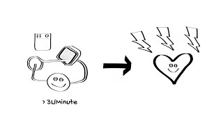 Introduction to ECMO Part 4  ECPR ECMO CPR [upl. by Weibel]