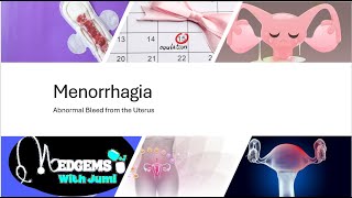 Menorrhagia Never let heavy periods stop you Heres Top 7 causes that require your attention [upl. by Anelra]