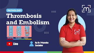 Thrombosis and Embolism with Dr Priyanka Sachdev [upl. by Ellis]