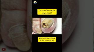 Terbinafine tablet Uses part 1 [upl. by Alfons238]